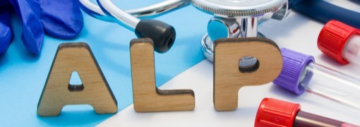 בדיקת רמות פוספטזה בסיסית בדם (Alkaline Phosphatase)   - תמונה